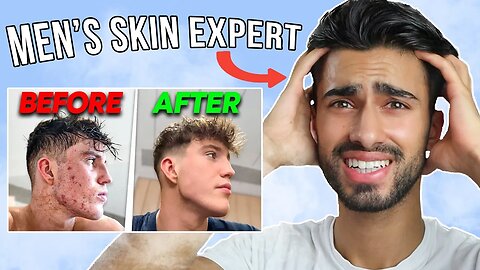 Men's Skin Expert Reacts To Joe Fazer "How I Cleared My Acne"