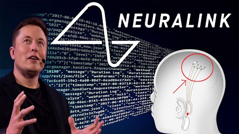 Elon Musk e il progetto NEURALINK - servizio RAI