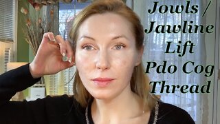 #JOWLS / #JAWLINE #PDO COG THREAD #nonsurgicalfacelift