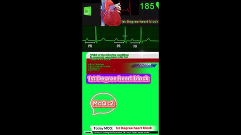 First degree heart blockages #fibrillation #arterialflutter #Supraventriculartachycardia