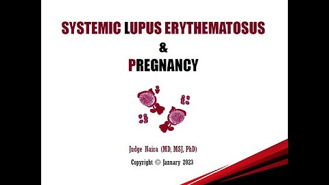 SYSTEMIC LUPUS ERYTHEMATOSUS in Pregnancy