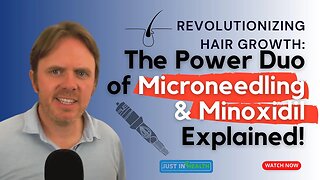 Revolutionizing Hair Growth: The Power Duo of Microneedling & Minoxidil Explained!