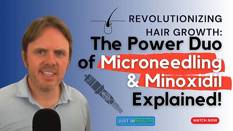 Revolutionizing Hair Growth: The Power Duo of Microneedling & Minoxidil Explained!