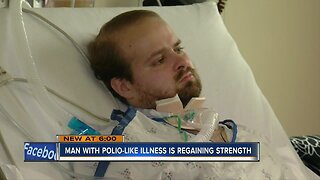 Milwaukee man diagnosed with polio-like illness shares story