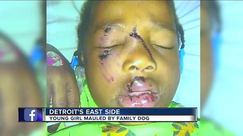 4-year-old girl mauled by family dog in Detroit