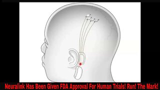 Neuralink Has Been Given FDA Approval For Human Trials! Run! The Mark!