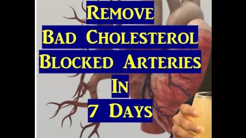 100% Working Method :- Remove Bad Cholesterol Blocked Arteries In Just 7 Days