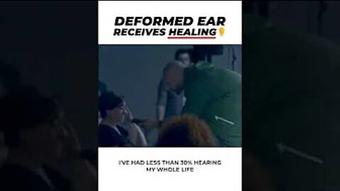 Deformed Ear Receives Healing 👂 #shorts