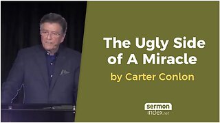 The Ugly Side of A Miracle by Carter Conlon