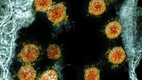 First Case Of COVID-19 Reinfection Confirmed In U.S.
