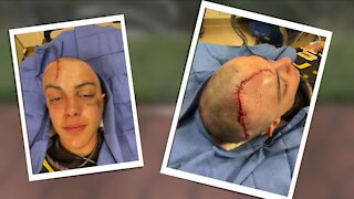 Traumatic injury leads to 500 stitches but doesn't deter 12-year-old boy from pursuing baseball