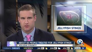60 stung by jellyfish on Florida beach