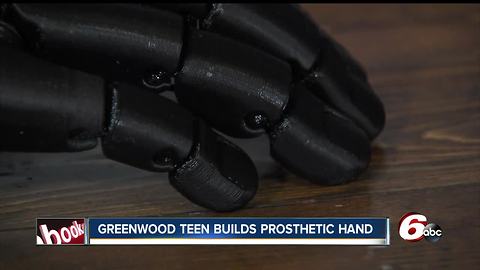 Teen uses 3D printer he built himself to make a prosthetic hand