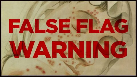 WARNING! Timeline Shows Threat of Incoming Smallpox False Flag -