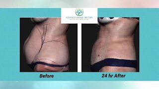 Advanced Image Med Spa and Elite Wellness Center: Lose fat and shrink inches FAST