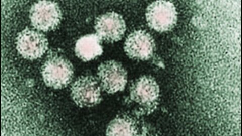 State lawmakers hold news conference in Stuart about hepatitis A outbreak