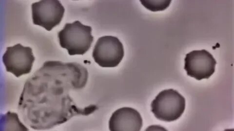 A human white blood cell chasing a bacterium