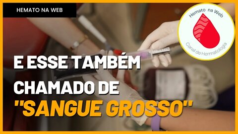 "Sangue grosso", isso existe mesmo? [Policitemia] | Geydson S Cruz; MD,MSc