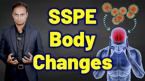 Changes in the body due to SSPE, Subacute Sclerosing Panencephalitis | Homeopathy Treatment & Cure