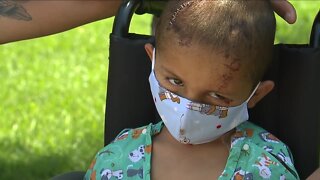 Aurora 4-year-old, victim of a hit-and-run, faces months of recovery
