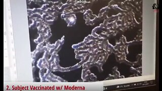 Parasites in the vaccine laying eggs caught live on Camera - 2-20-22