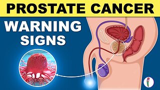 Signs That You Have Prostate Disease |Warning Signs Of