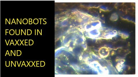 Shocking Self-Replicating Nanobots Found in Both Vaxxed and UnVaxxed
