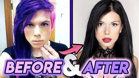 Blaire White | Before and After Transformations | Trans YouTuber Plastic Surgery Transformation