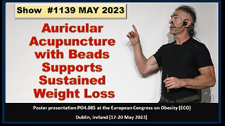 Ear acupuncture with beads may help shed the pounds Episode 1139 MAY 2023