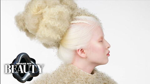 Disowned Because Albinism Brings 'Bad Luck' | SHAKE MY BEAUTY