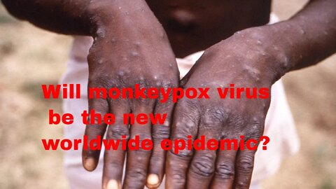 Will monkeypox be the new worldwide epidemic?