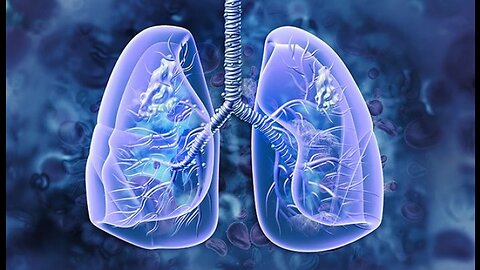 How to Prevent Lung Cancer