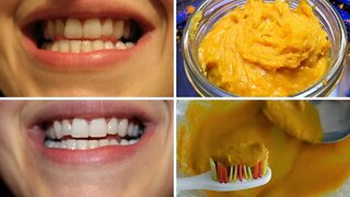 How to Naturally Whiten Your Teeth at Home