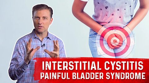 What is Interstitial Cystitis (Painful Bladder Syndrome)? – Symptoms & Remedy Covered by Dr.Berg