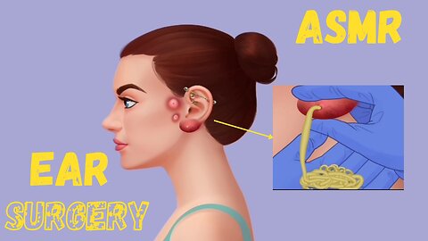 ASMR world bast doctor's ear surgery new video