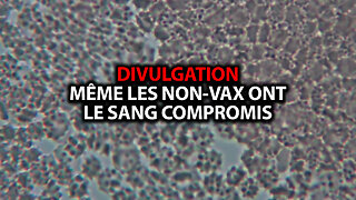 RÉINFORMATION 10/03/2023 - DIVULGATION: MÊME LES NON-VACCINÉS ONT LE SANG COMPROMIS