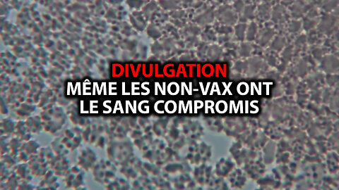 RÉINFORMATION 10/03/2023 - DIVULGATION: MÊME LES NON-VACCINÉS ONT LE SANG COMPROMIS