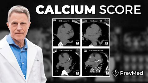 Coronary Calcium Score - How Your Score Relates to Heart Disease Risk