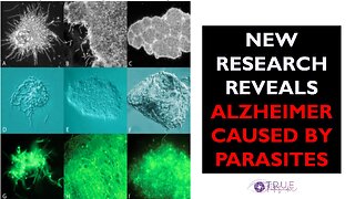 NEW RESEARCH REVEALS - ALZHEIMER CAUSED BY PARASITES | True Pathfinder