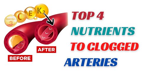 HOW TO UNCLOG YOUR ARTERIES NATURALLY - TOP 4 NUTRIENTS FOR CLOGGED ARTERIES