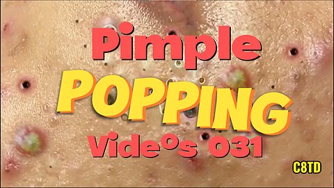 Satisfying Pimple Popping Videos 031