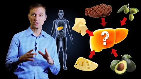 Will Eating Fat Make My Liver Fat? – Dr.Berg On Causes of Fatty Liver & High Fat Foods