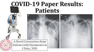 Review of COVID-19 Paper Results: Patients