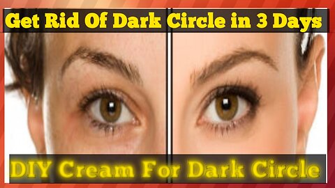 How to get rid of dark circles| DIY eye cream for dark circles | Homeremedy