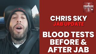 Chris Sky: JAB UPDATE - NEW SHOCKING BLOOD TESTS!