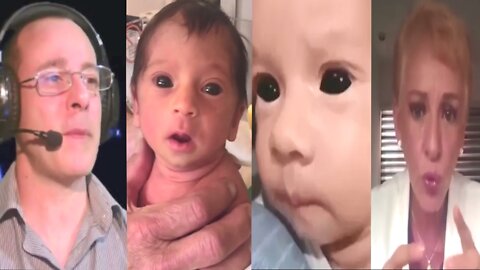 PANDEMIC BABY Occhi Completamente Neri,Bambini con Evoluzione Accelerata- Dr.Delgado & Dr.Brunet (2022) Black-Eyed Babies - Condividi!