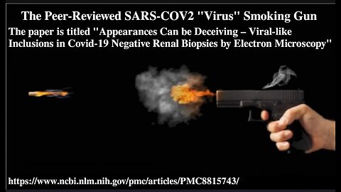 The SARS-COV2 Smoking Gun Fraud. There is no virus. (11 minute watch)