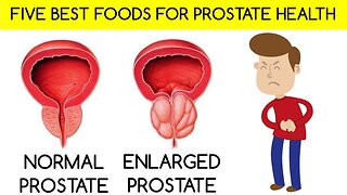 How to Shrink Enlarged Prostate with these 5 Essential Diets