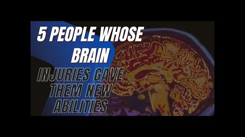 5 People Whose Brain Injuries Gave Them New Abilities