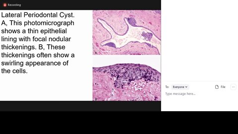 pathology L7 part1 (gingival cyst)